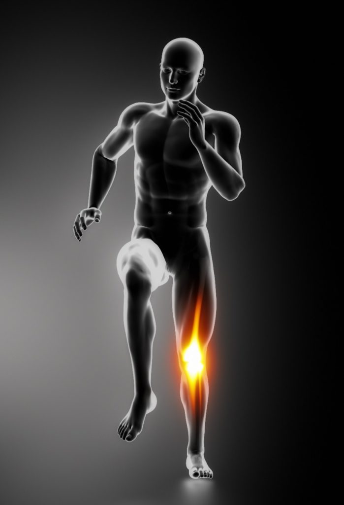 Render 3D de figura humana correndo com o joelho destacado em luz alaranjada indicando dor articular localizada