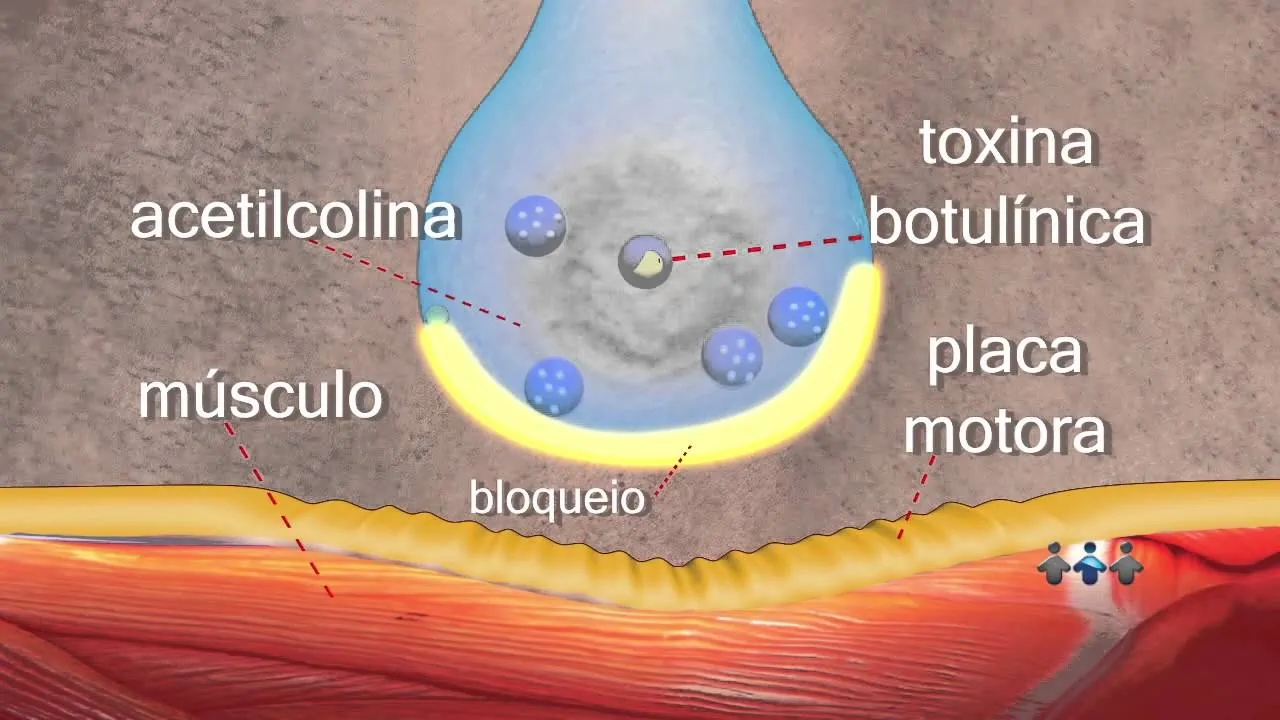 mecanismo acao toxina botulinica