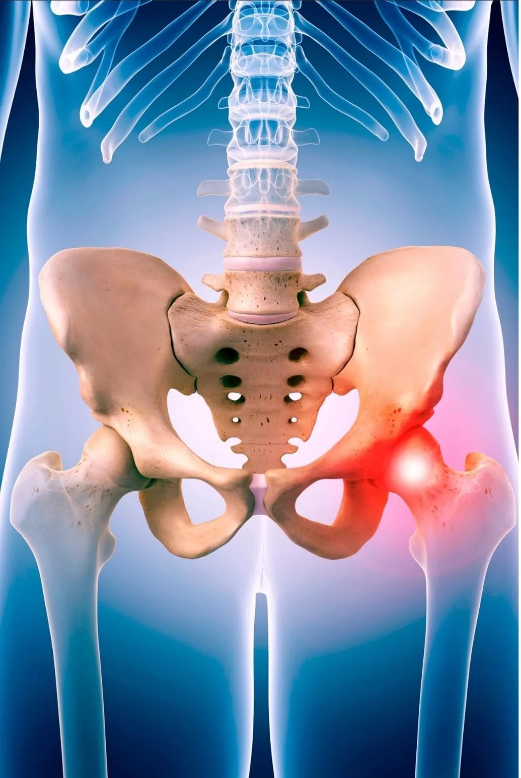 Dor no quadril causas e tratamentos Clínica Dr. Hong Jin Pai Dor