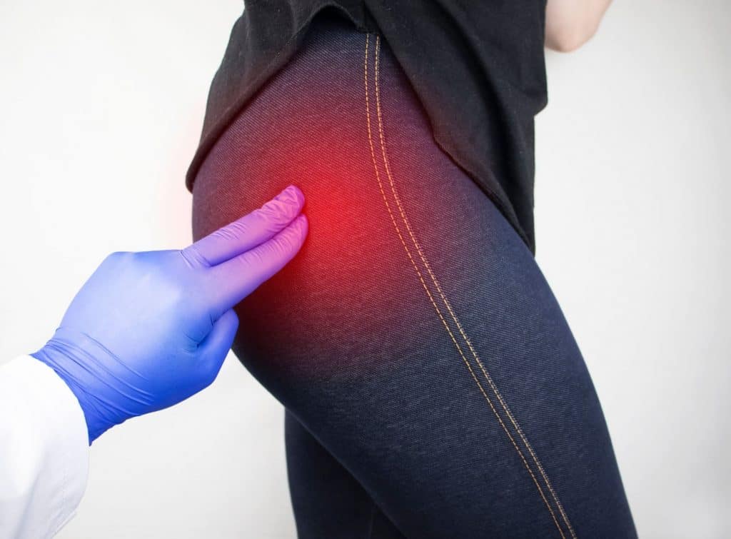 Mão com luva azul de profissional de saúde pressionando a região do glúteo de uma pessoa, com área avermelhada indicando dor no ponto palpado.