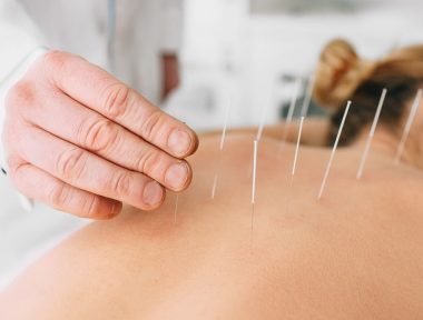 benefícios da acupuntura