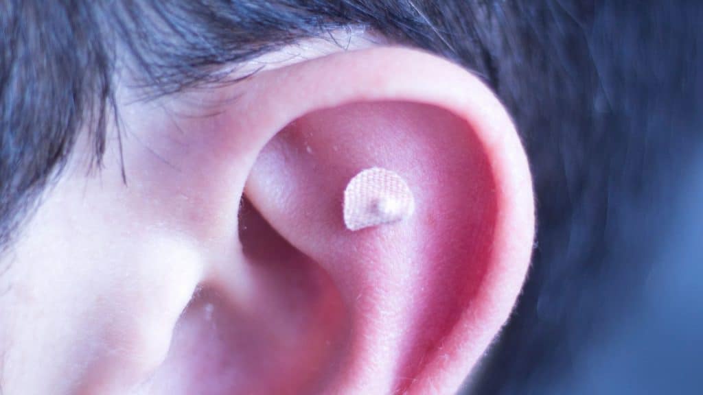 Par de radiografias frontais da coluna lombar: a da esquerda mostra as vértebras sem implantes e a da direita mostra a mesma coluna com parafusos pediculares e hastes metalicas fixando os segmentos.