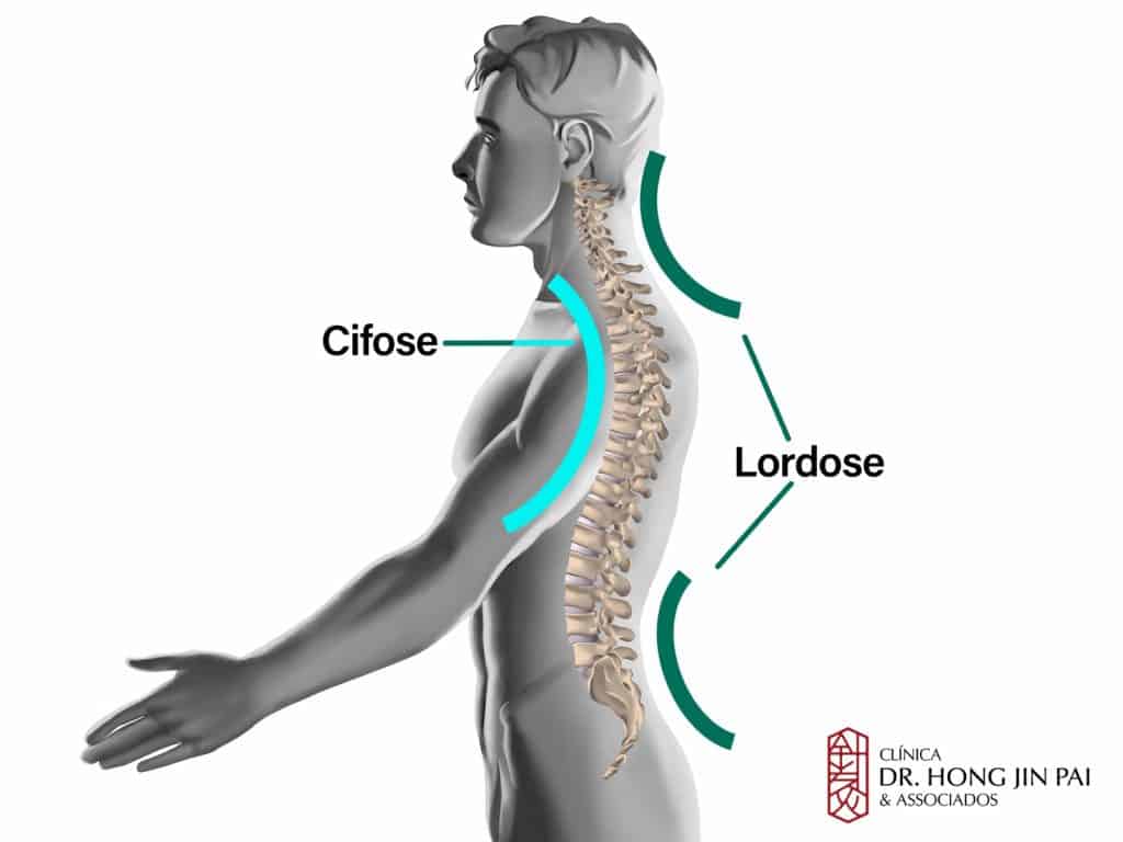 Render 3D de perfil do corpo humano com a coluna vertebral visível, indicando a curvatura da cifose torácica e da lordose lombar e cervical.