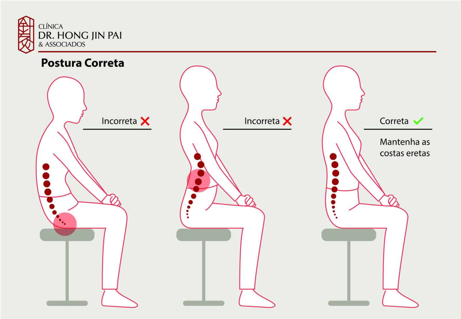 Infografico - Dor no Coccix