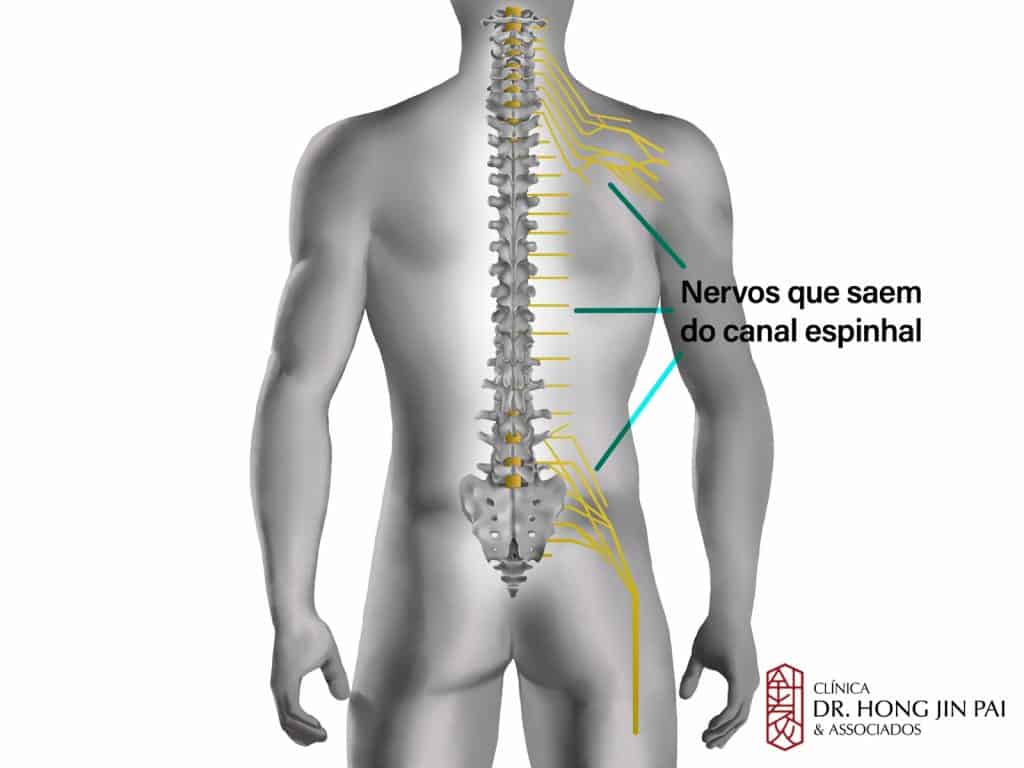 Figura masculina translucida de costas exibindo a coluna e os nervos amarelos que saem do canal espinhal para o tronco