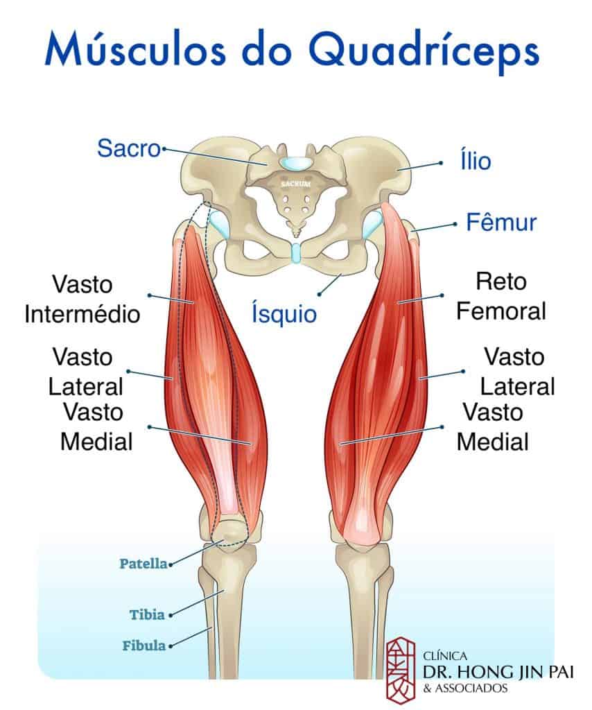 Diagrama anatômico dos músculos do quadríceps com pelve, fêmur e patela, identificando reto femoral, vasto lateral, vasto medial e vasto intermédio.