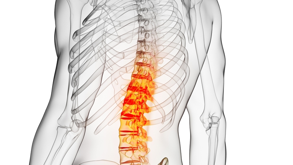 inflamação na coluna