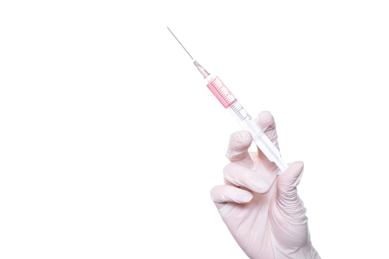 Mão com luva segurando uma seringa fina preparada para a aplicação da toxina botulínica