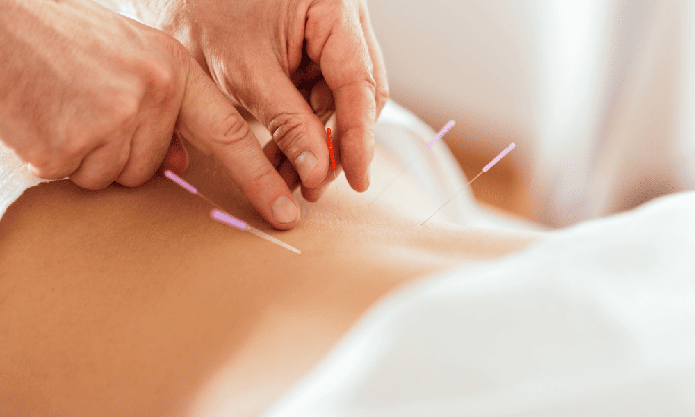 A acupuntura é segura para a dor na coluna lombar?