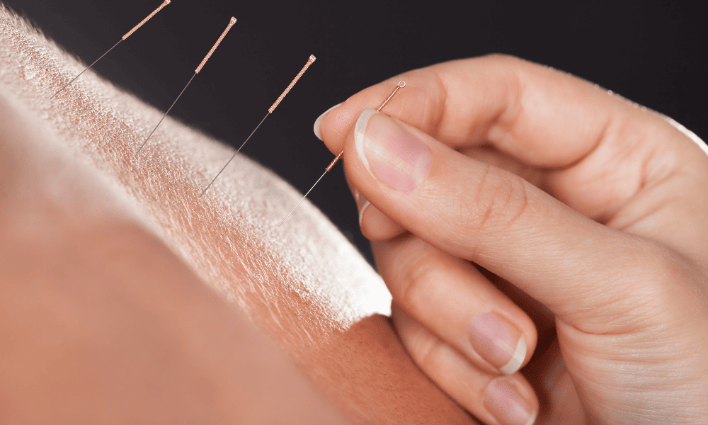 Pontos de acupuntura para dor na coluna cervical - Saiba quais são