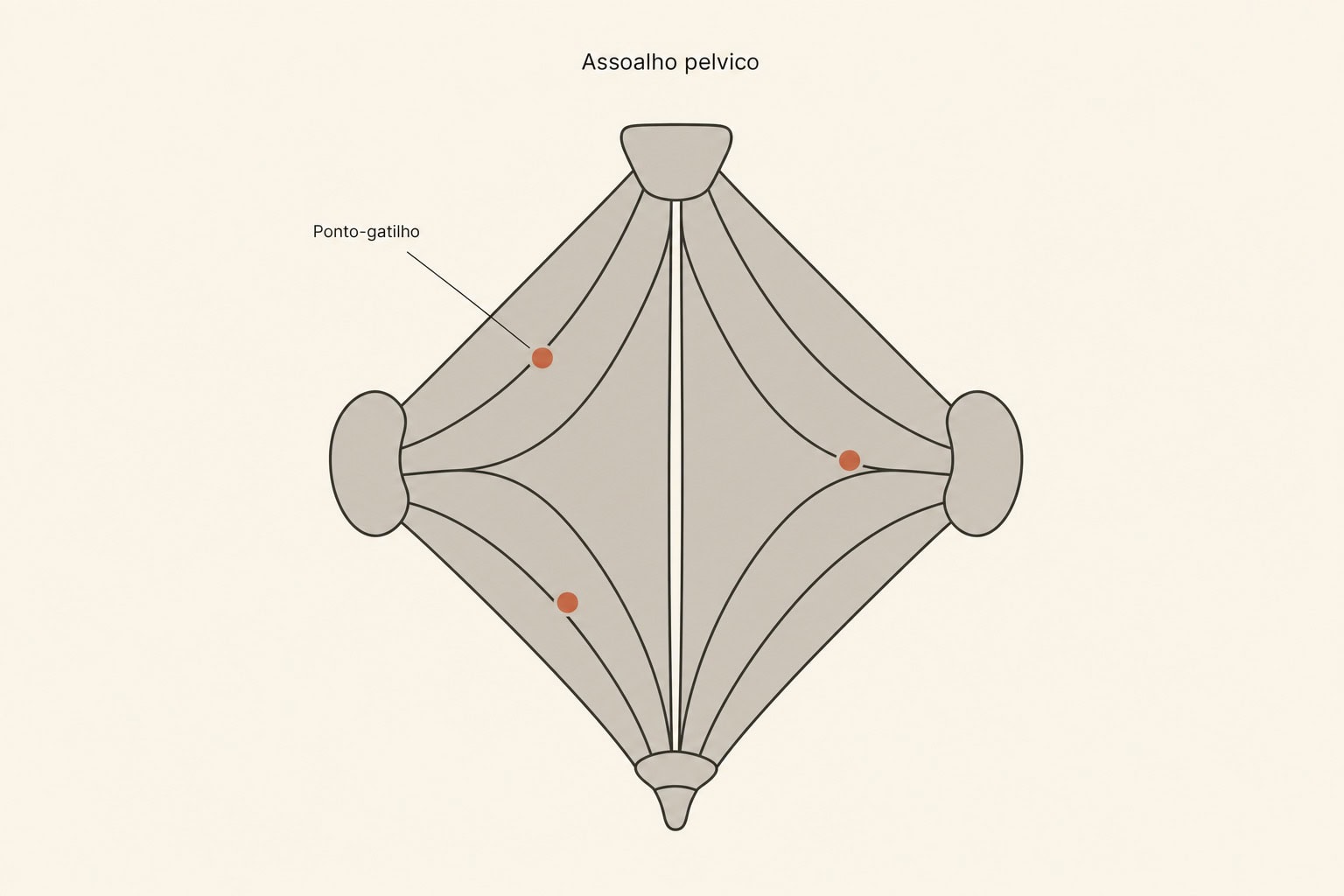 Diagrama do assoalho pélvico visto por baixo, em formato de losango entre o púbis, os ísquios e o cóccix, com três pontos-gatilho marcados em laranja na musculatura.