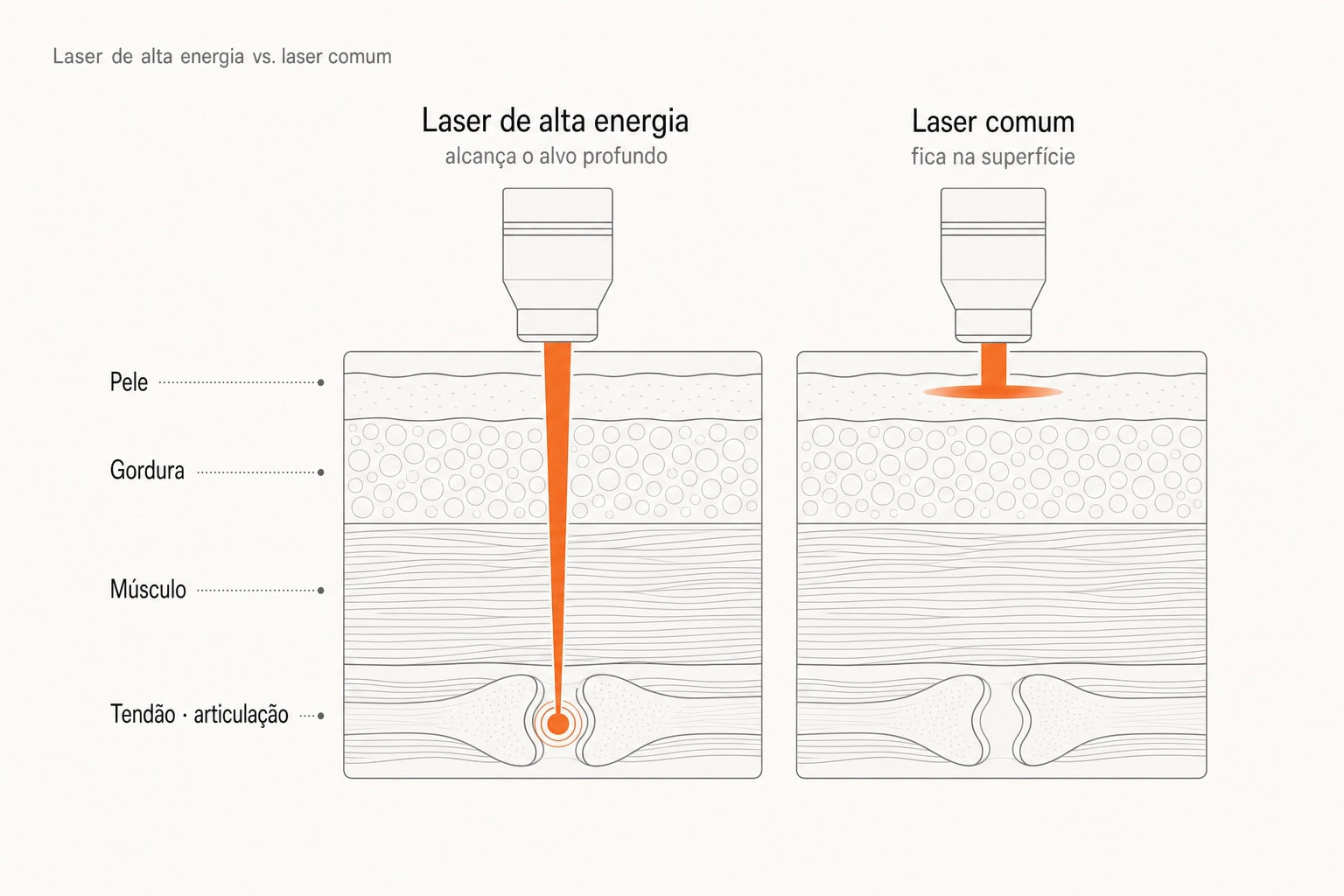 Comparação: o laser de alta energia alcança o alvo profundo, enquanto o laser comum fica na superfície.