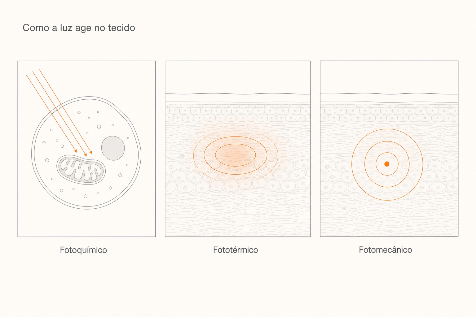 Diagrama em estilo Dieter Rams dos três efeitos da luz do laser no tecido: fotoquímico (fotobiomodulação na mitocôndria), fototérmico (calor em profundidade) e fotomecânico (onda de pressão).