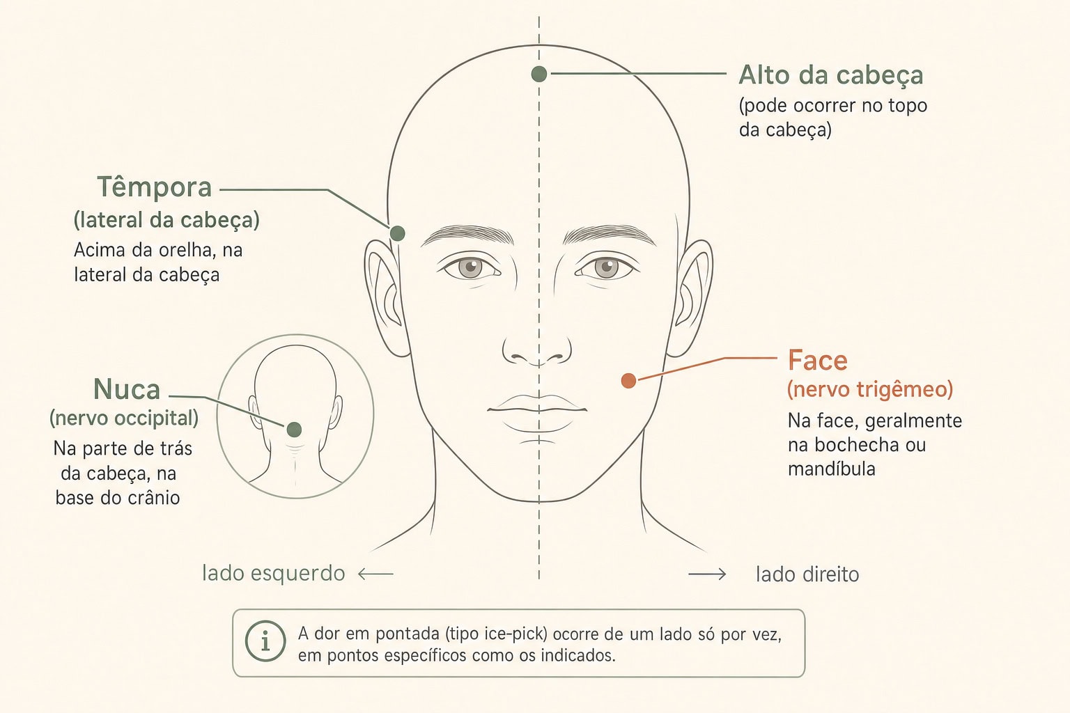 Mapa das regiões onde a pontada na cabeça costuma ocorrer: têmpora (lateral da cabeça, acima da orelha), nuca (nervo occipital), face (nervo trigêmeo) e alto da cabeça, com a linha central separando lado esquerdo e lado direito