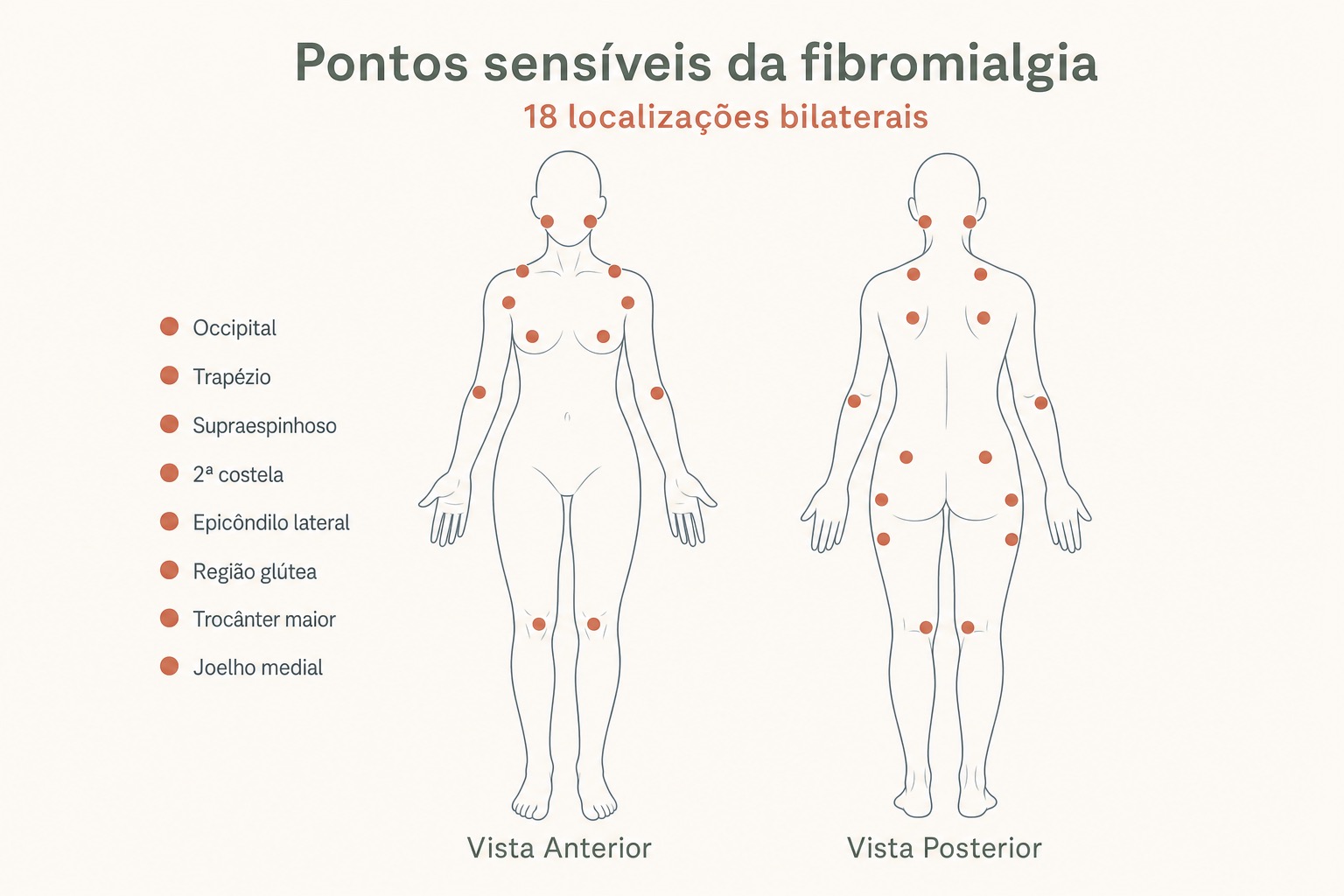 Fibromialgia melhora? 7 Ilustração do corpo de uma pessoa com chamadas apontando sintomas da fibromialgia: sintomas centrais (cefaleia, depressão, ansiedade, problemas de sono), oculares, muscular, urinário, gastrointestinal, sistêmicos e osteoarticulares