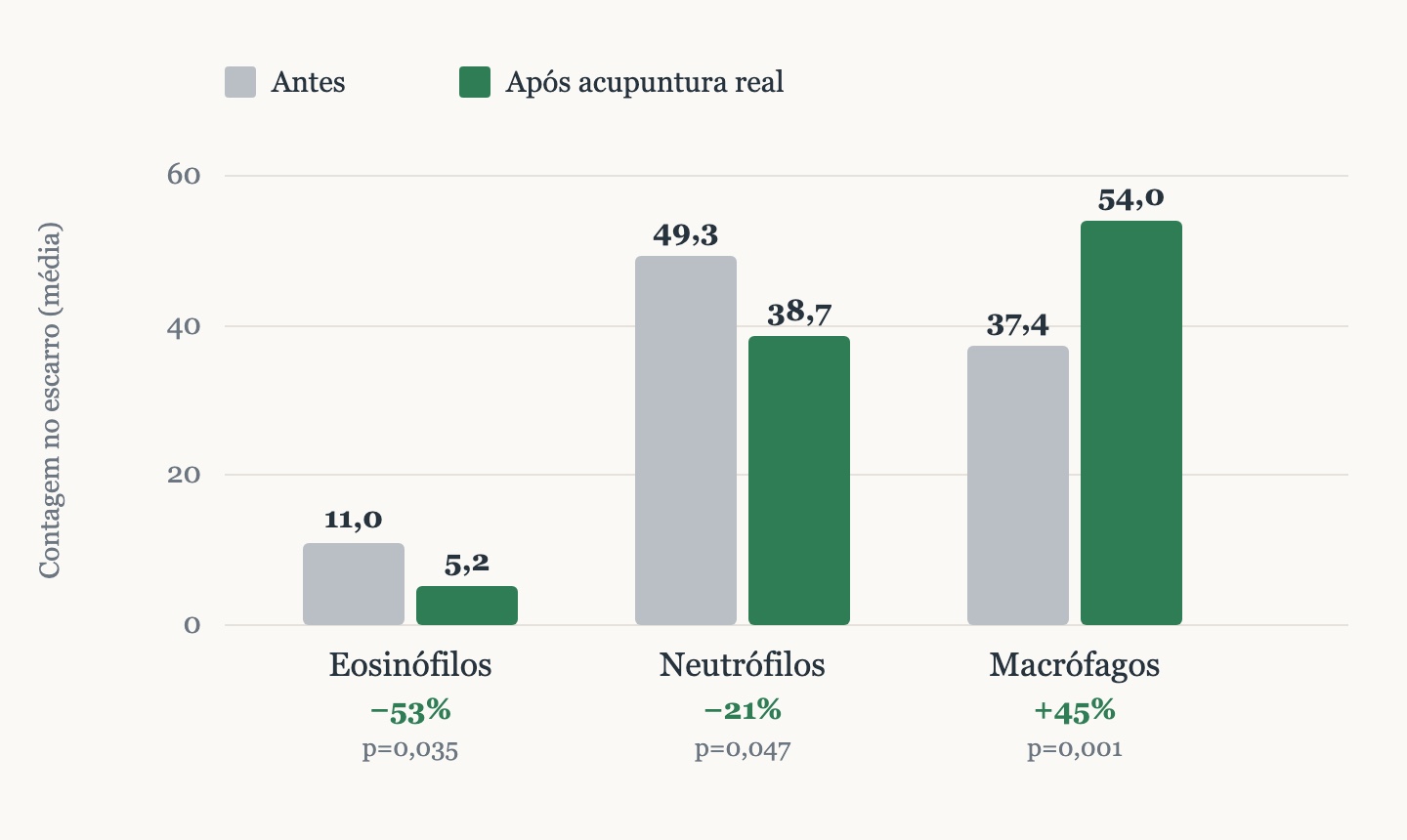 Gráfico das células inflamatórias no escarro induzido antes e após a acupuntura real: eosinófilos caem 53%, neutrófilos caem 21% e macrófagos sobem 45%.