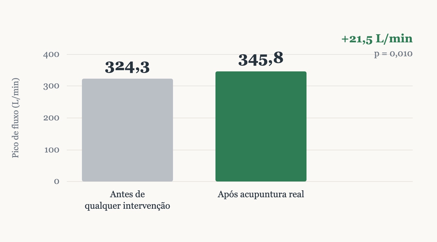 Gráfico do pico de fluxo expiratório antes e após a acupuntura real: aumento de 324,3 para 345,8 litros por minuto, diferença de 21,5, p igual a 0,010.