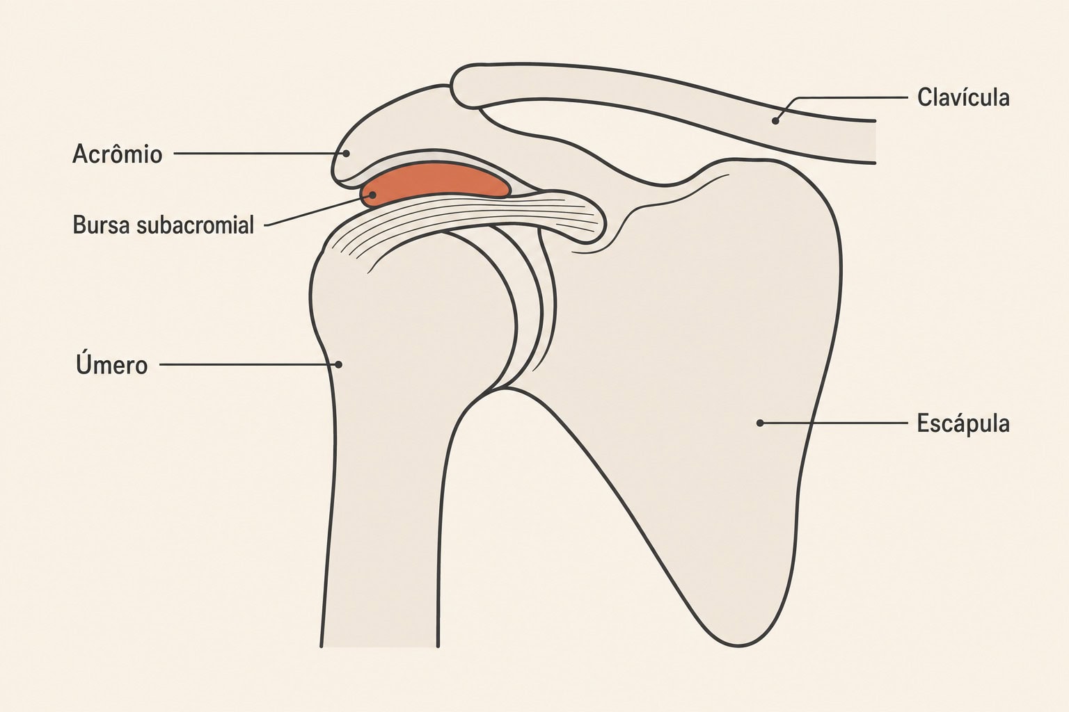 Diagrama do ombro em corte mostrando a bursa subacromial inflamada entre o acrômio e o tendão
