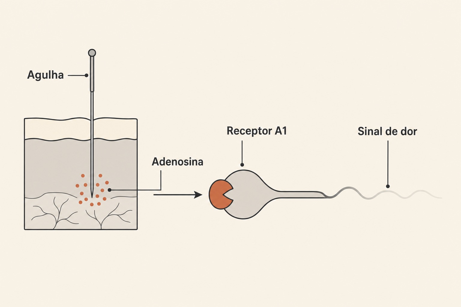Diagrama do mecanismo de analgesia da acupuntura: agulha libera adenosina, que atua no receptor A1 e reduz o sinal de dor